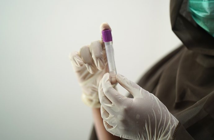 Νέα «υπερευαίσθητη» εξέταση αίματος ανιχνεύει βιοδείκτη πολλών καρκίνων