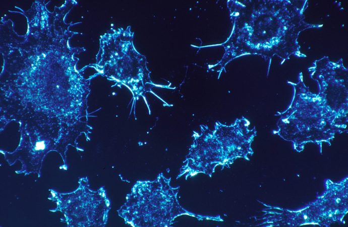 Επιστήμονες εντόπισαν «διακόπτη» που προκαλεί την αυτοκαταστροφή των καρκινικών κυττάρων