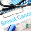 Μελέτη: Ο ετήσιος προσυμπτωματικός έλεγχος για καρκίνο του μαστού από τα 40 σώζει ζωές
